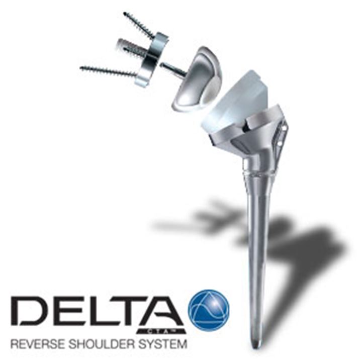 Typische Delta III Prothese der Schulter (sogenannte Umkehrprothese)
