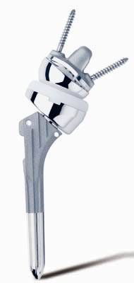 Sogenannte Umkehrprothese oder Inverse Prothese nach Grammont