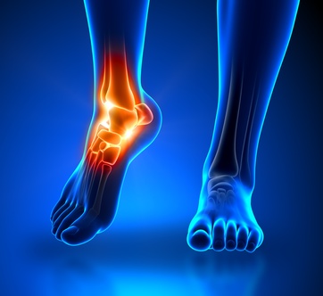 Fuss Sprunggelenk Orthozentrum Cham Zug Schweiz Orthopadische Chirurgie Dr Med Rolf F Oetiker